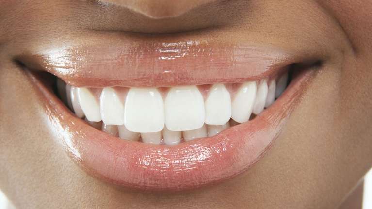 A smiling woman | dentist 92879
