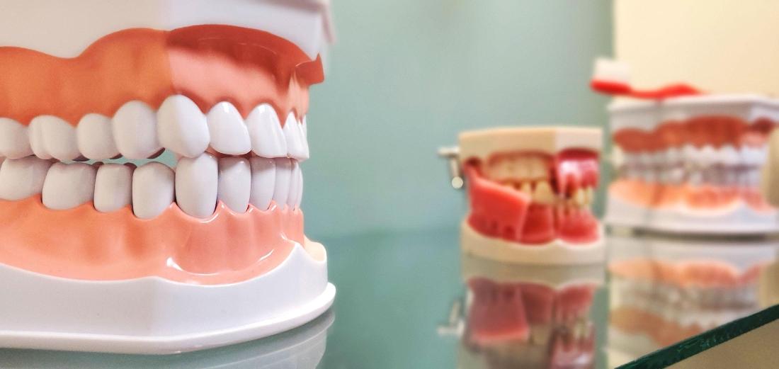 Multiple teeth models at Dental Care of Corona